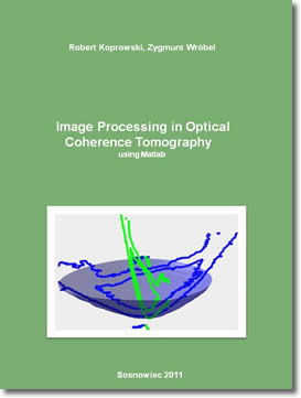 Download Gratis eBook Image Processing