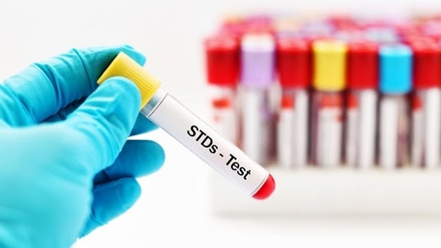 std testing sexually transmitted disease tests sti infections laboratory