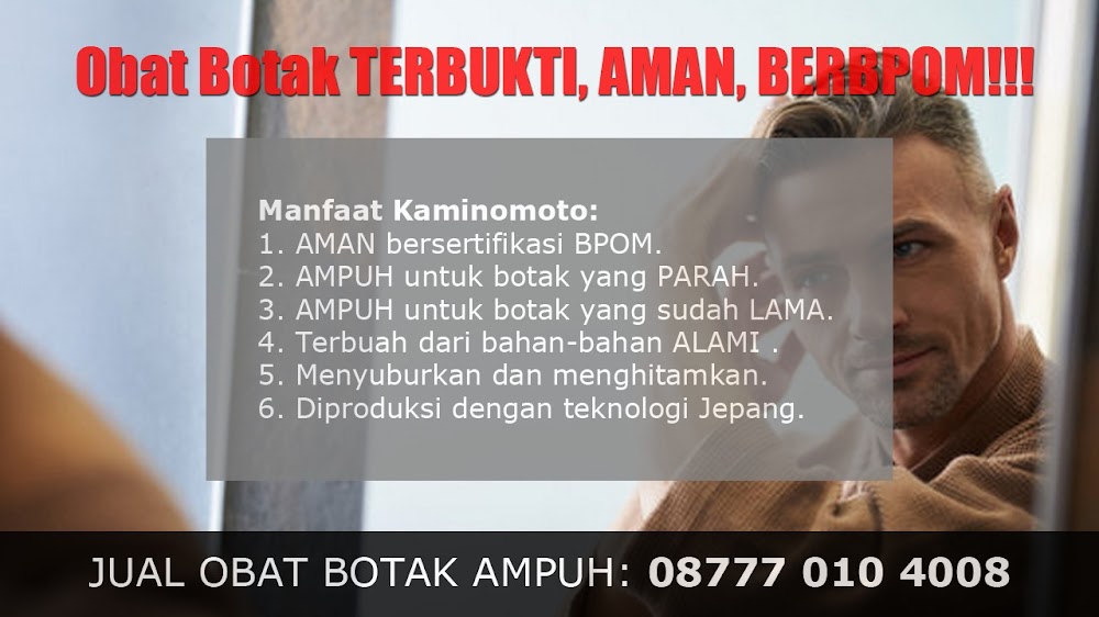 CARA MENUMBUHKAN RAMBUT WANITA YANG BOTAK<br/>Solok Selatan<br/>