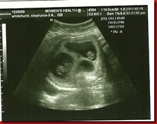 triplets @ 9.5 weeks