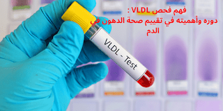 فهم فحص VLDL: دوره وأهميته في تقييم صحة الدهون في الدم