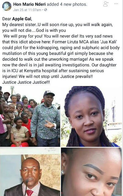 Photos: 21-year-old Kenyan woman dies after being allegedly raped and doused with acid by her estranged husband