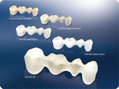 Răng sứ cercon có tốt không khi phục hình răng nhai?-2