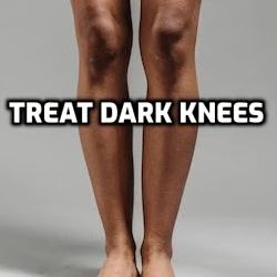 treat dark knees. Foot and Legs of a Person