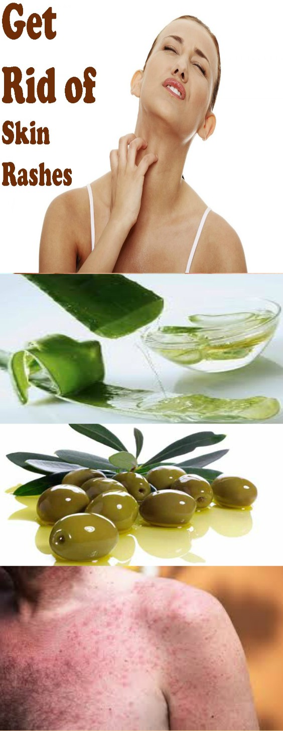 Health+Beauty HOW TO GET RID OF SKIN RASHES