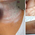 How To Lighten Dark Neck Within 15 Minutes!