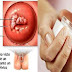 The Gynecologist Will Not Tell You This Because It Is A Homemade Product - It Destroys Fungi, Bacteria And The Smell Of Fish