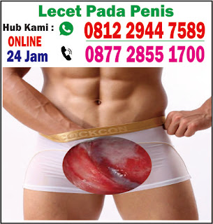 salep khusus penis dan buah zakar lecet