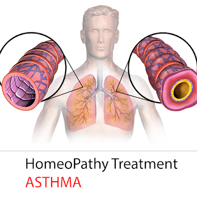 homeopathic treatment for asthma