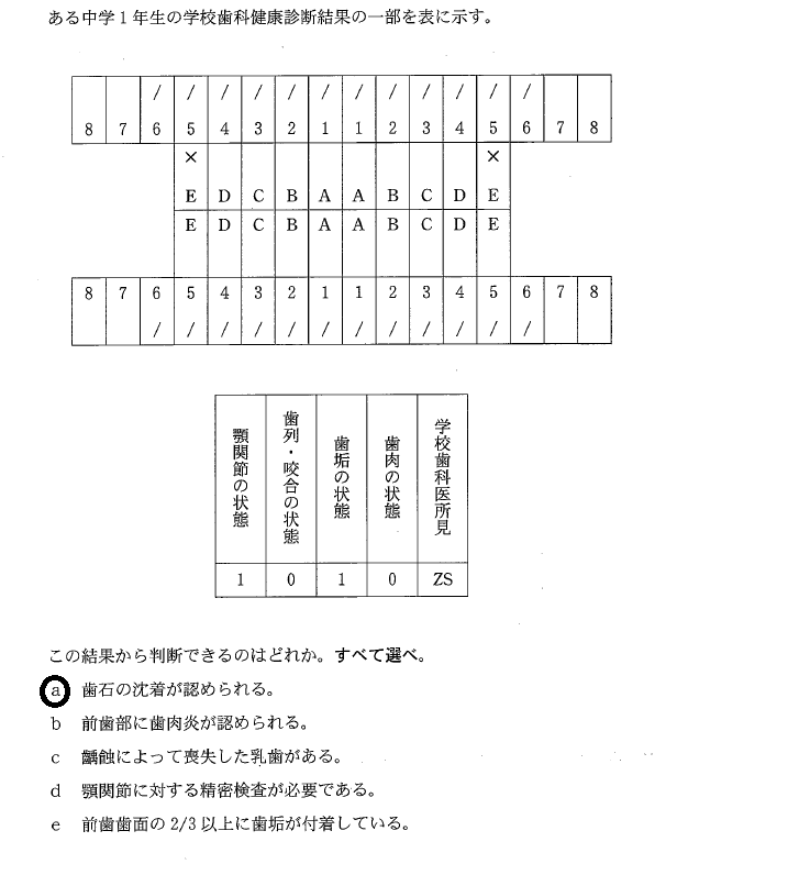 東京デンタルスクール代表岡田の歯科医師国家試験と雑感ブログ 学校歯科健診 定期試験 歯科医師国家試験対策