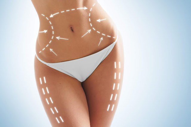 Liposuction Surgery In Vizag