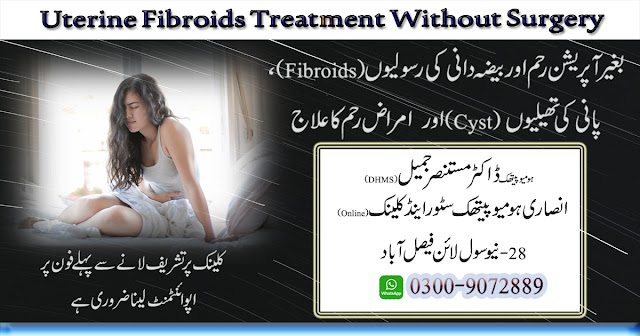 Uterine Fibroids Treatment without Surgery