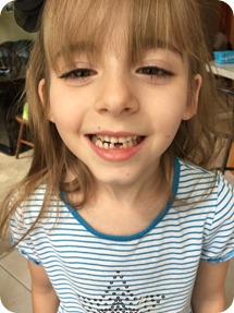 Elaine lost her first tooth!