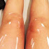 This photo of someone’s legs has divided the Internet — are they oily legs or white paint marks?