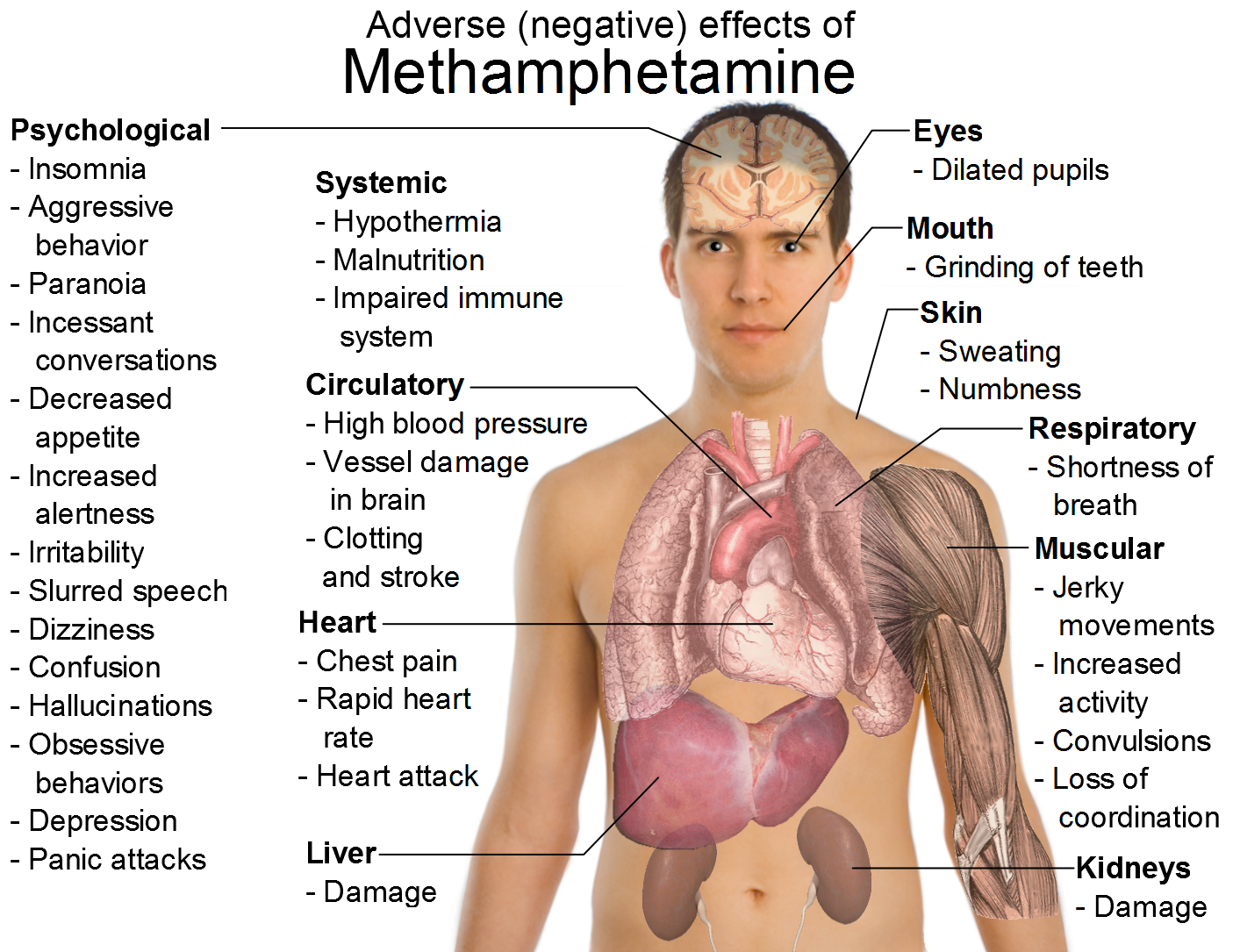 https://blogger.googleusercontent.com/img/b/R29vZ2xl/AVvXsEjoETuXYLMu61T1NZc5PHPmpZtAJgfsbX8rt8tUnuXwZswSOtnSUGXf2JYYpl8by8jcO1sP23ED7t7K01yow0ulz6zPp1gsmBE0dvK4i5VxPSAn373VPHVfrIfkE017arA1Piq2GdipxEY/s1600/Effects_of_metamphetamine.png