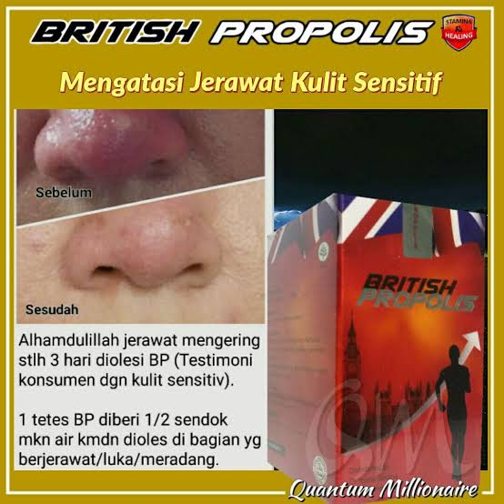 manfaat british propolis untuk wajah