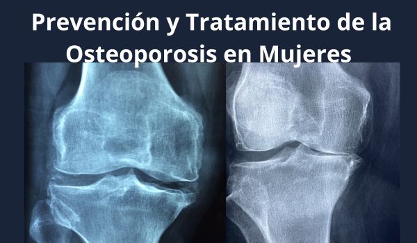 Prevención y Tratamiento de la Osteoporosis en Mujeres