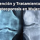  Prevención y Tratamiento de la Osteoporosis en Mujeres