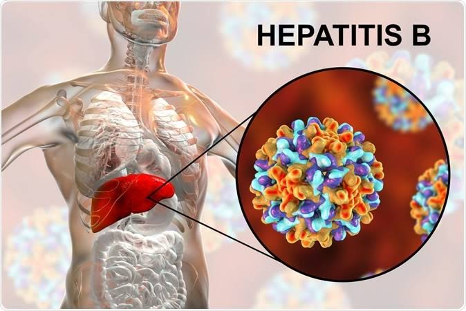 Hepatitis B : Diagnosis, Complication and Prevention
