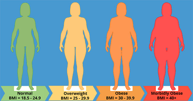 sobrepeso y obesidad