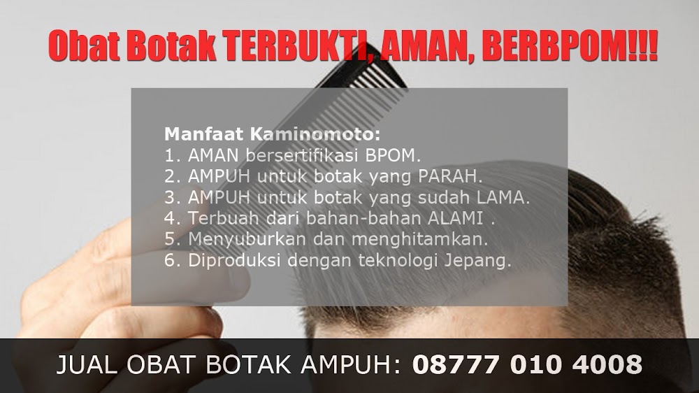 jual OBAT PENUMBUH RAMBUT BOTAK Sugapa<br/>