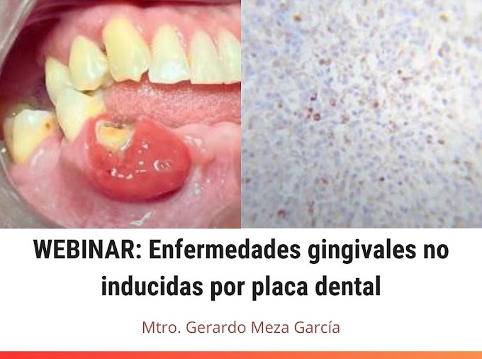 WEBINAR: Enfermedades gingivales no inducidas por placa dental - Mtro. Gerardo Meza García