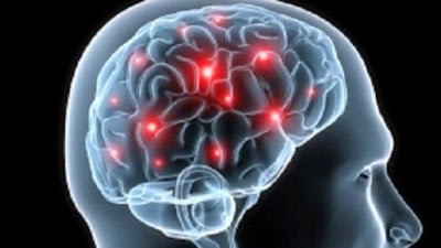 Discovering the benefits of "diet brain"