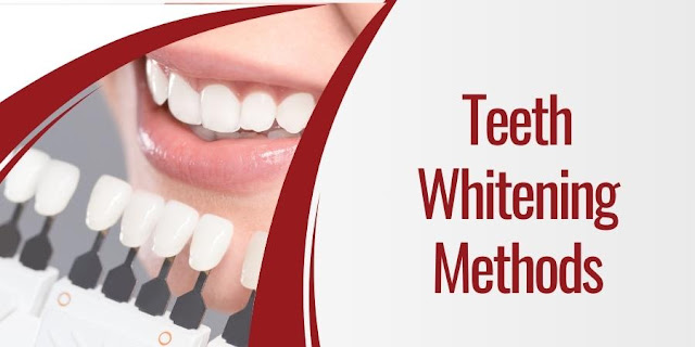 Teeth Whitening Methods