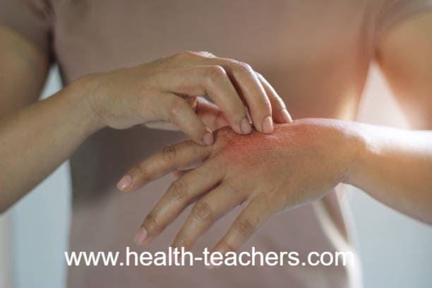 Skin symptoms that should prompt immediate medical attention - Health-Teachers