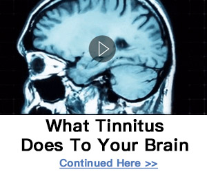 What Tinnitus does to your brain