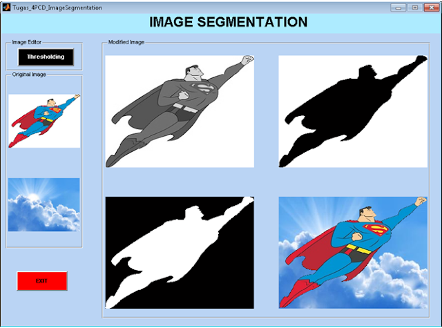 Program Segmentasi Gambar Dengan Metode Thresholding Menggunakan Matlab