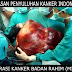 ASAL USUL KANKER DI RAHIM !!! SHARING UNTUK PARA WANITA (BILA PRIA YG TERIMA TOLONG DI TERUSKAN KE WANITA? DI SEKITAR ANDA)"