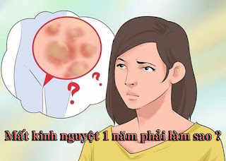 Mất kinh nguyệt 1 năm phải làm sao?