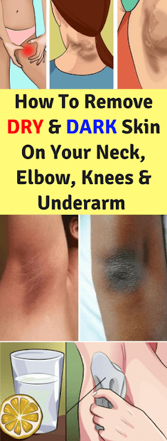 How To Remove Dry & Dark Skin On Your Neck, Elbows, Knees & Underarms!!!
