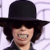 CRAZY: See what Lady gaga did to her mouth for the YouTube Music Awards (PHOTO)