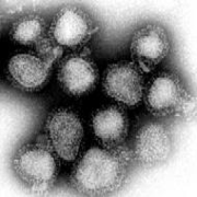 Suspeita de caso de gripe suína no Brasil