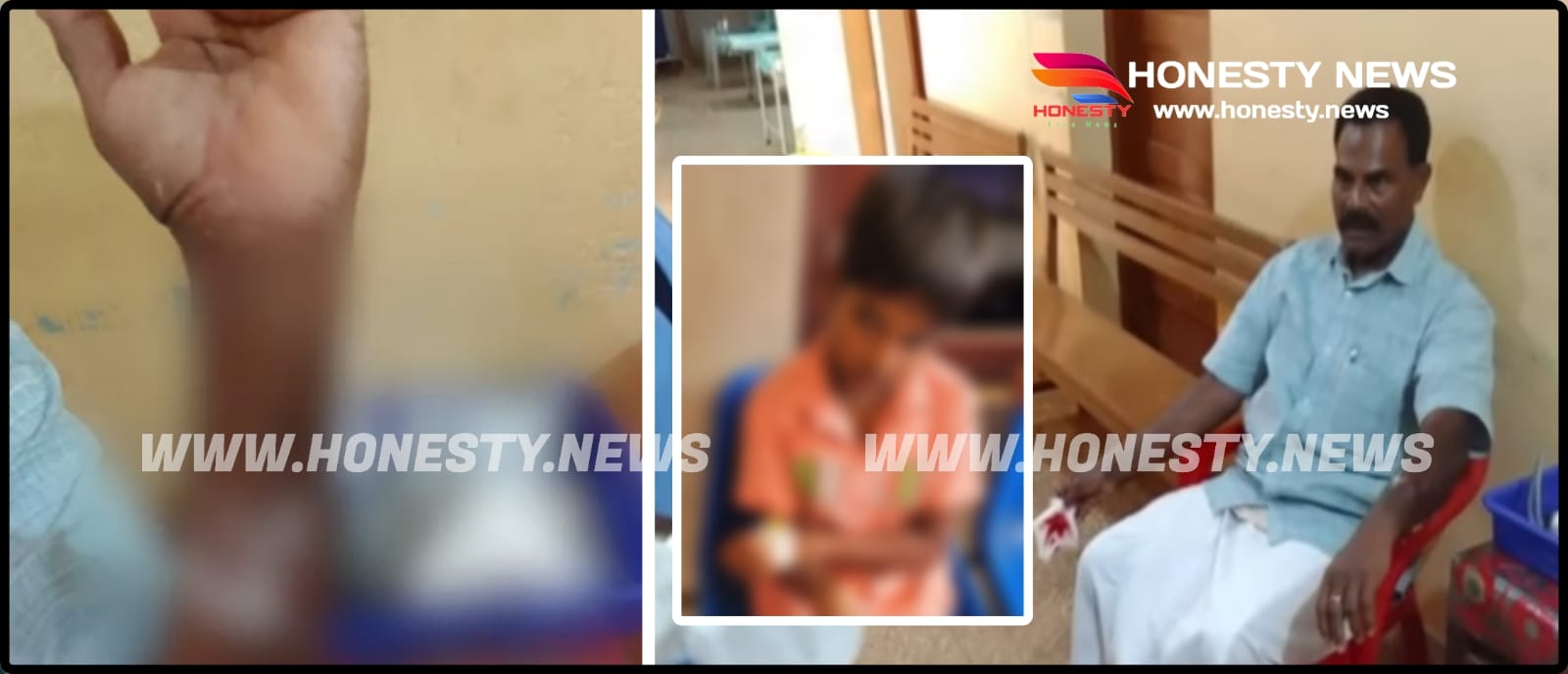ഇടുക്കി രാജകുമാരിയിൽ തെരുവ്നായ ആക്രമണം; പതിനൊന്നു വയസുള്ള കുട്ടി ഉൾപ്പെടെ മൂന്ന് പേർക്ക് പരിക്ക്. ഇടുക്കി രാജകുമാരിയിൽ തെരുവ്നായ ആക്രമണം; പതിനൊന്നു വയസുള്ള കുട്ടി ഉൾപ്പെടെ മൂന്ന് പേർക്ക് പരിക്ക്.