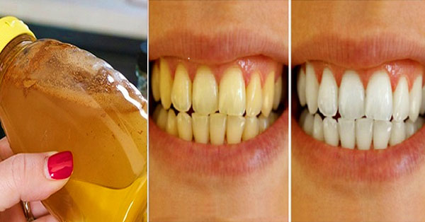 Natural Home Remedy to Whiten your Teeth