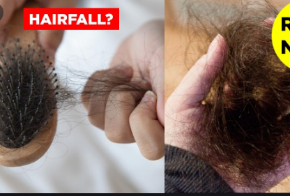 How to stop my hair from falling out and thinning