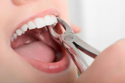 Alasan Dokter Gigi Tak Mau Cabut Gigi Ketika Masih Sakit, Ternyata Efeknya Mematikan