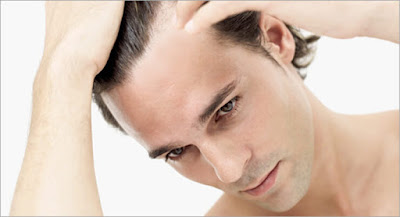  ArganRain Androgenic Alopecia