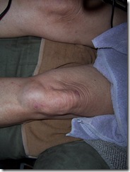 more knee whack 8.4.09 004