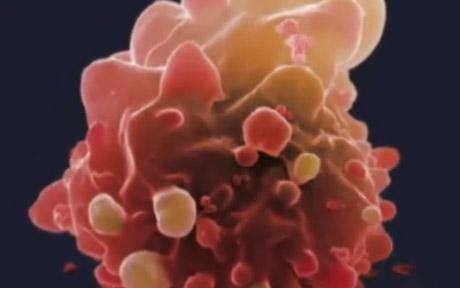 Células cancerosas mortas pela quimioterapia poderiam fazer o câncer se espalhar