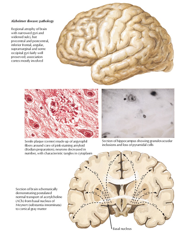 Alzheimer Disease: Cholinergic Involvement and Drugs