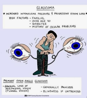 Glaucoma thuộc nhóm bệnh lý mắt nguy hiểm, khiến mắt dần dần mất đi thị lực mà không có biểu hiện nghiêm trọng