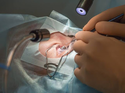 A perfect procedure