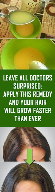 Leave All Doctors Surprised: Apply This Remedy and Your Hair Will Grow Faster Than Ever