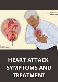 HEART ATTACK SYMPTOMS AND TREATMENT