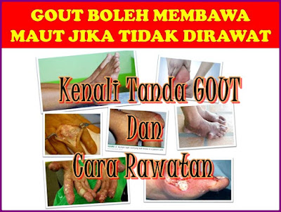 penawar gout