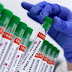 Aprueba Unión Europea el uso de la vacuna Bavarian contra la viruela del mono
